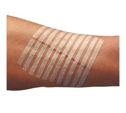 Suture Strips - Image 2